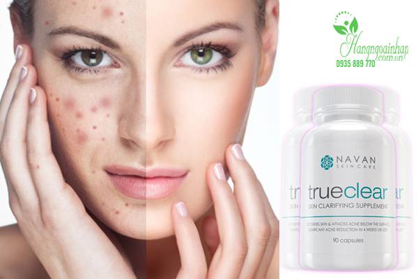 Viên uống trị mụn Navan TrueClear Skin Clarifying Supplement 