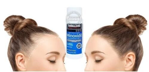 https://www.hangngoainhap.com.vn/cdn3/images/491-thuoc-moc-toc-tri-hoi-dau-minoxidil-5-kirkland-cua-my14(1).jpg