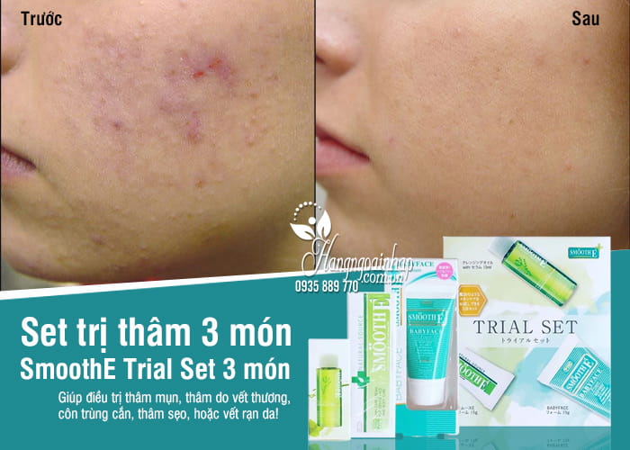 Set trị thâm SmoothE Trial Set 3 món - nội địa Nhật Bản 15g 7