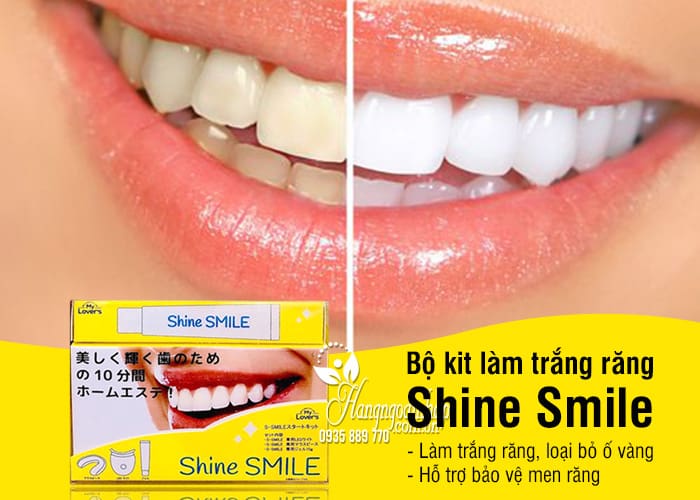 Bộ kit làm trắng răng Shine Smile của Nhật Bản (máy và tuýp kem) 3
