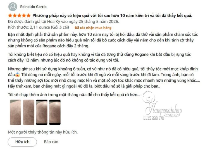 Mọc tóc Men’s Rogaine Minoxidil 5% Foam