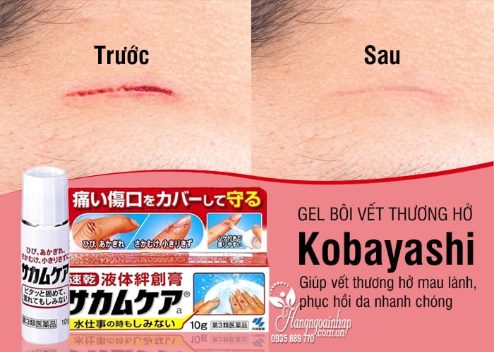 Gel bôi vết thương hở Kobayashi 10g của Nhật Bản  6