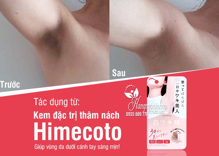 Kem đặc trị thâm nách Himecoto Nhật Bản mẫu mới 2020 1