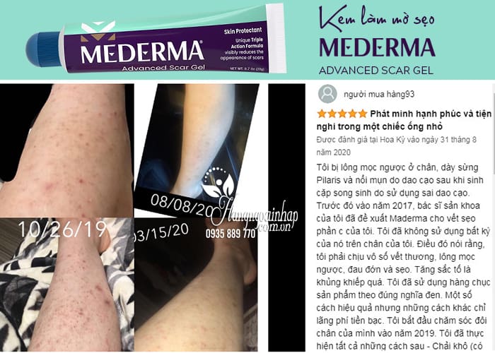 Kem làm mờ sẹo Mederma Advanced Scar Gel 20g của Mỹ 9
