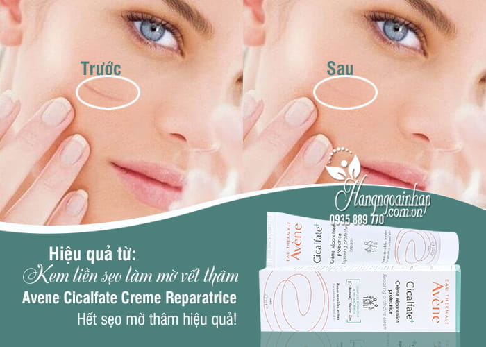 Kem liền sẹo làm mờ vết thâm Avene Cicalfate Creme Reparatrice 3