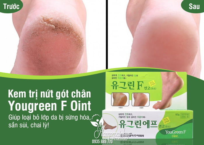 Kem trị nứt gót chân Yougreen F Oint của Hàn Quốc tuýp 60g 1