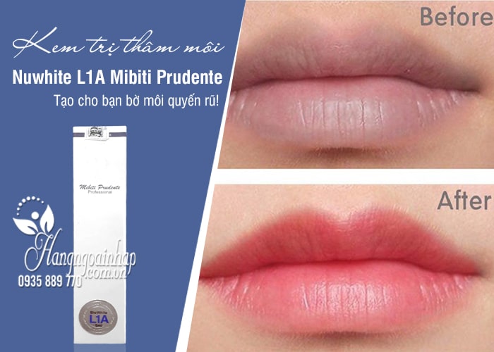 Kem trị thâm môi Nuwhite L1A Mibiti Prudente của Mỹ  1