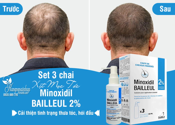 Set 3 chai xịt mọc tóc Minoxidil Bailleul 2% của Pháp 5