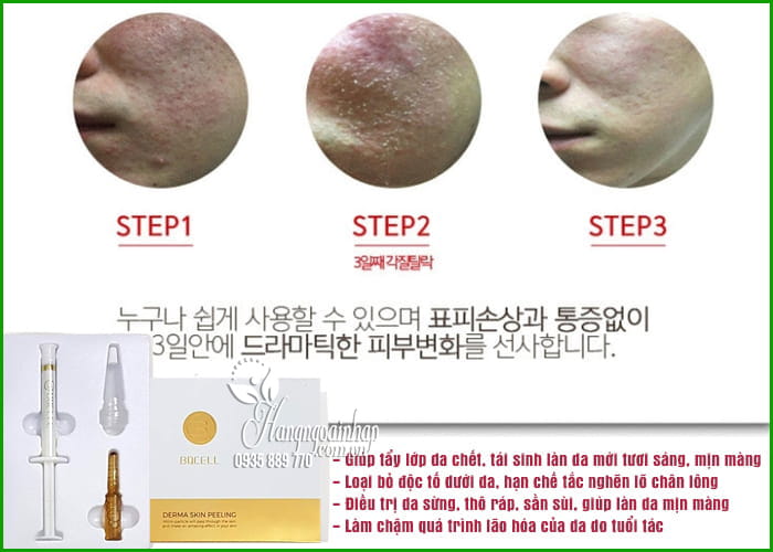 Thay da sinh học Bqcell Derma Peeling Cream 2.0g Hàn Quốc 9