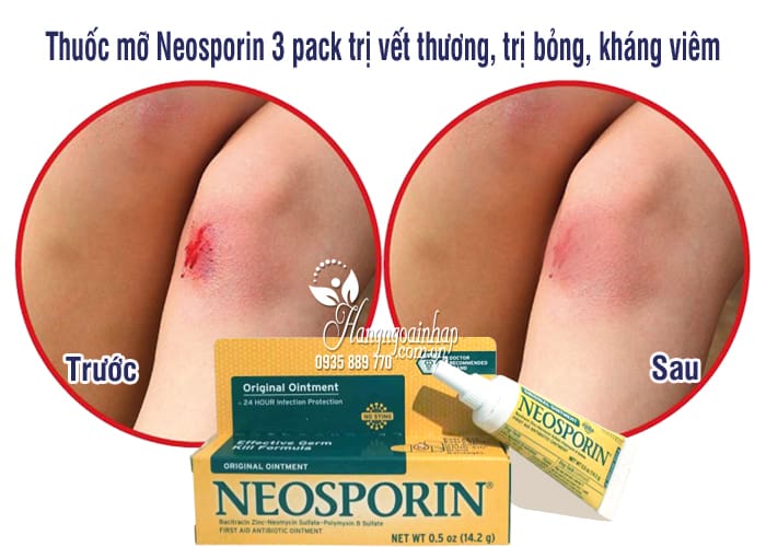 Thuốc mỡ Neosporin 3 pack trị vết thương, trị bỏng, kháng viêm 44