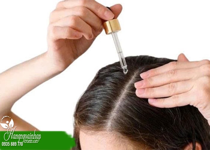 5 lưu ý khi dùng dung dịch mọc tóc tránh bị tác dụng phụ  1