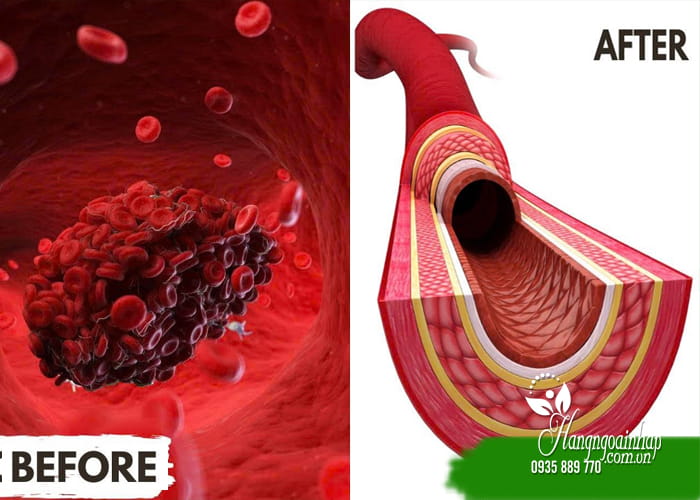 5 lưu ý khi sử dụng Nattokinase hỗ trợ tim mạch  45