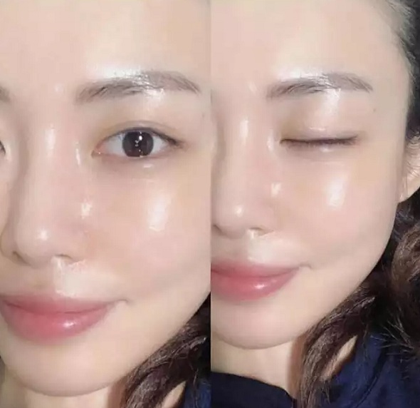 RETINOL VÀ RETINOID NÊN DÙNG GÌ TRONG ĐIỀU TRỊ DA?