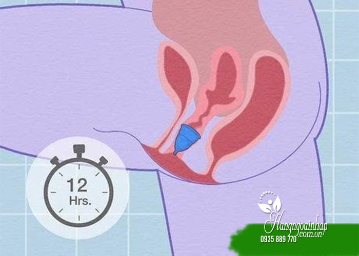 Bác sĩ nói gì về cốc nguyệt san? Có nên sử dụng không?  4