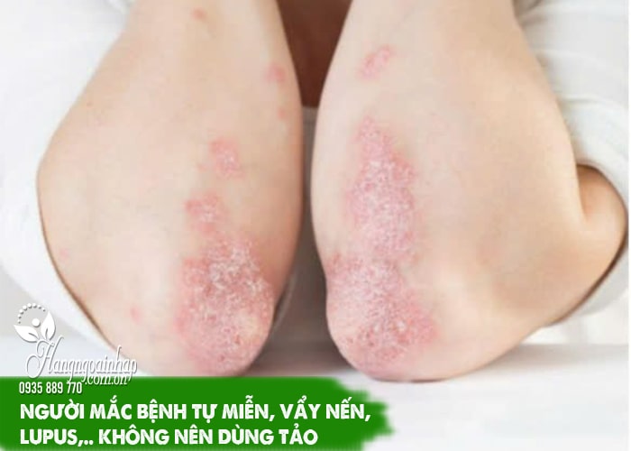 Đối tượng không nên dùng tảo Spirulina, lưu ý khi dùng 77