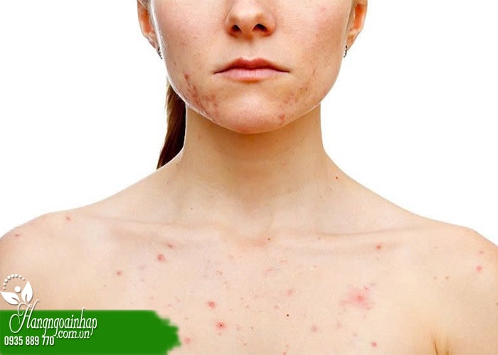 Dùng hồng sâm lát tẩm mật ong có gây nóng trong không? 34