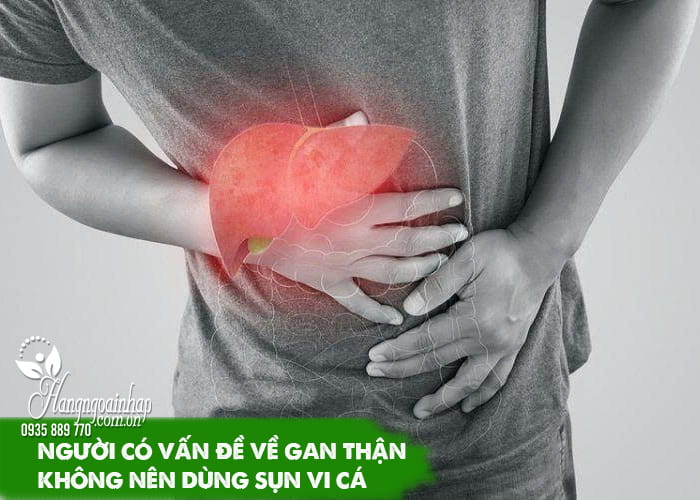 Những ai không nên dùng sụn vi cá mập 34