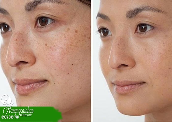 Review top 7 serum trắng da mờ thâm nám  6
