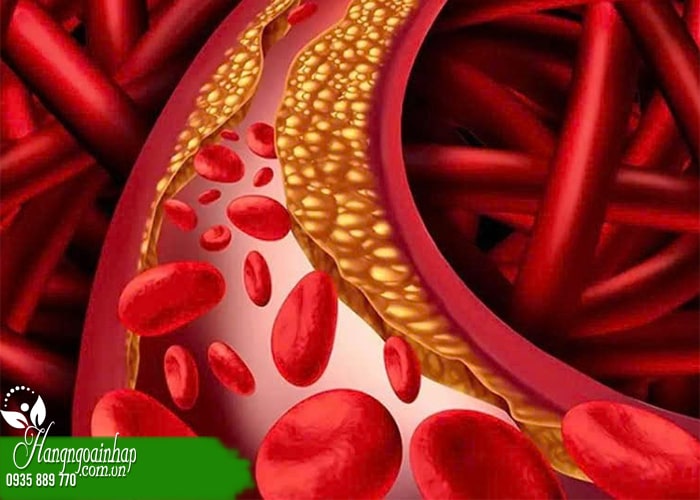 Top 5+ thuốc chống đột quỵ Nattokinase tốt nhất hiện nay  3