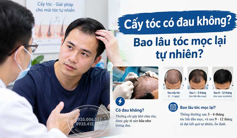 1. Cấy tóc có đau không? Cảm giác thực tế ra sao?1