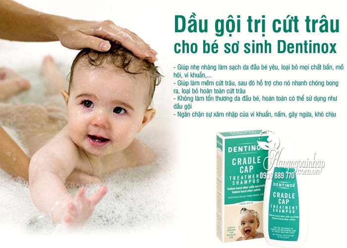 Dầu gội trị cứt trâu cho bé sơ sinh Dentinox 125ml Anh Quốc 5