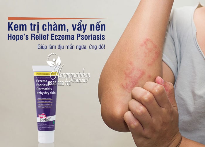 Kem trị chàm, vẩy nến Hope’s Relief Eczema Psoriasis Úc 1