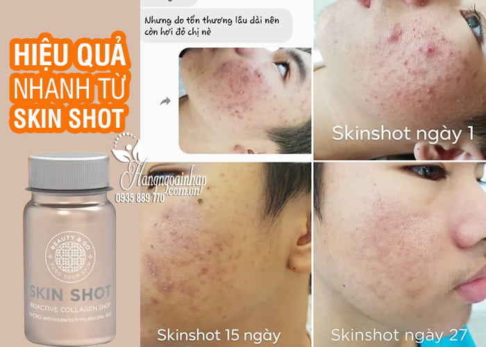 Nước uống đẹp da Skin Shot Bioactive Collagen 10 chai x 50ml 0