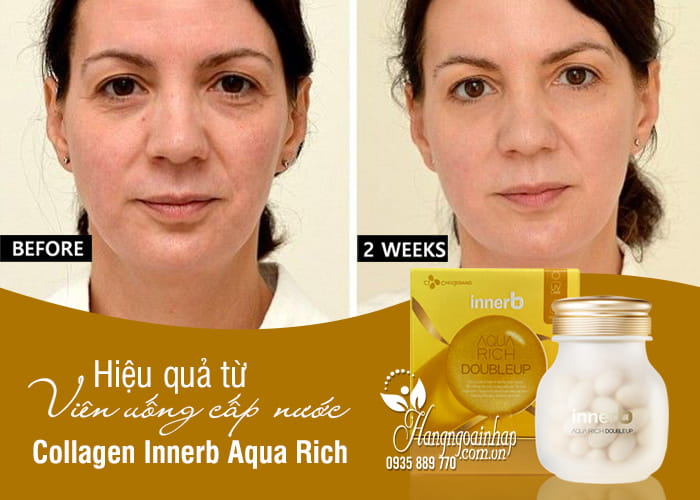 Viên uống cấp nước và Collagen Innerb Aqua Rich chính hãng 2