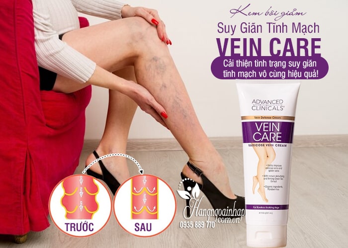 Kem bôi giảm suy giãn tĩnh mạch Vein Care 237ml Mỹ 3