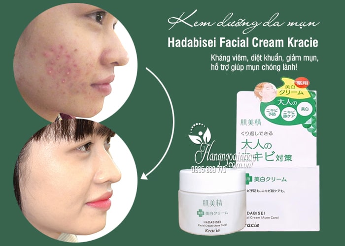 Kem dưỡng da mụn Hadabisei Facial Cream Kracie 50ml Nhật 1