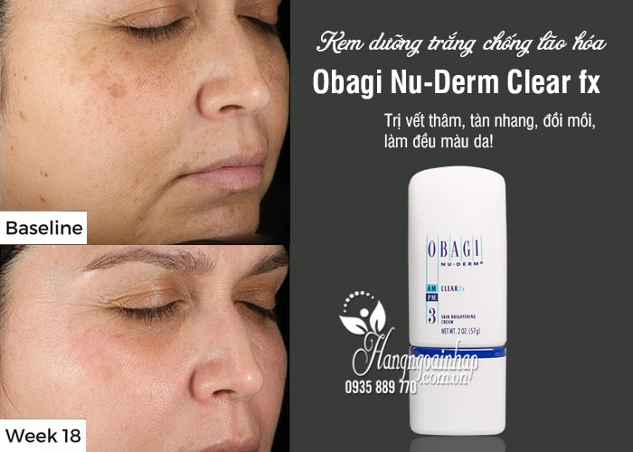 Kem dưỡng trắng chống lão hóa Obagi Nu-Derm Clear fx số 3 1
