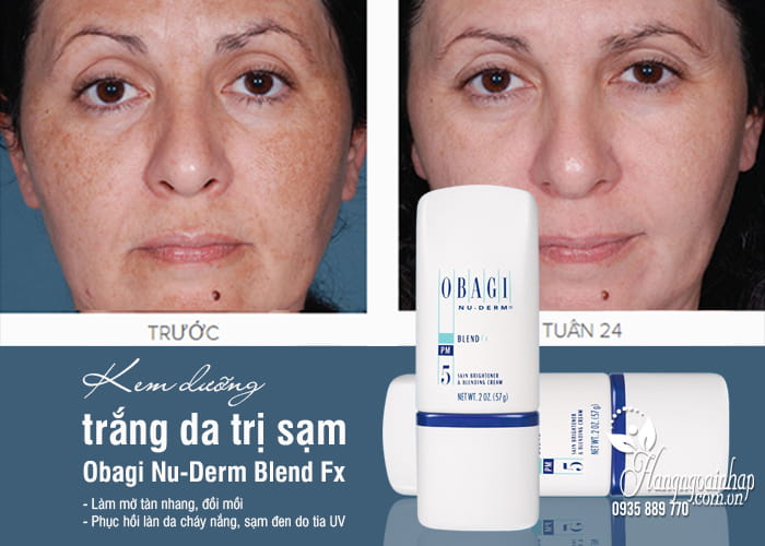 Kem dưỡng trắng da trị sạm Obagi Nu-Derm Blend Fx số 5 1