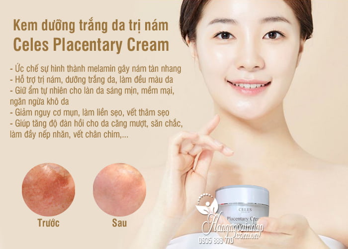 Kem dưỡng trắng da trị nám Celes Placentary Cream 50ml Hàn Quốc 7