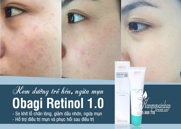 Kem dưỡng trẻ hóa, ngừa mụn Obagi Retinol 1.0 Cream 28g  1