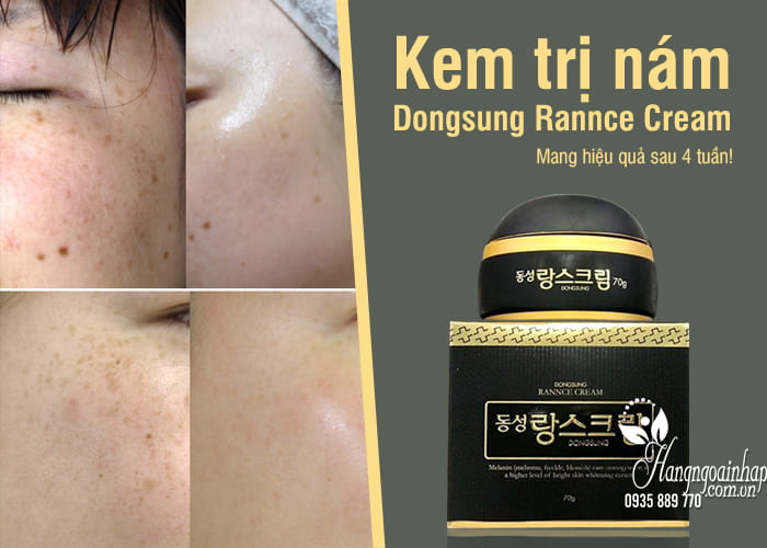 Kem trị nám Dongsung Rannce Cream Hàn Quốc, hộp 70g 8