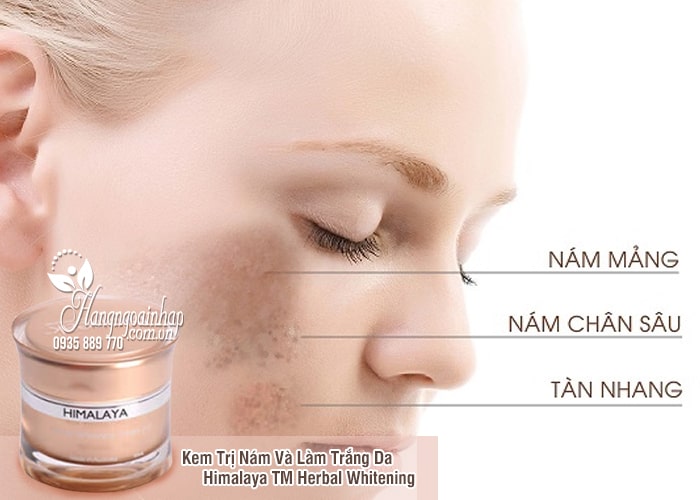 Kem Trị Nám Và Làm Trắng Da Himalaya TM Herbal Whitening 3