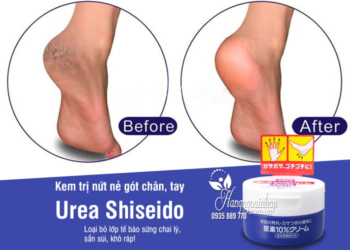1. Kem trị nứt gót chân shiseido urea cream của Nhật   