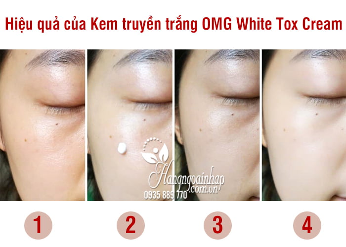 Kem truyền trắng OMG White Tox Cream 50ml Hàn Quốc 5
