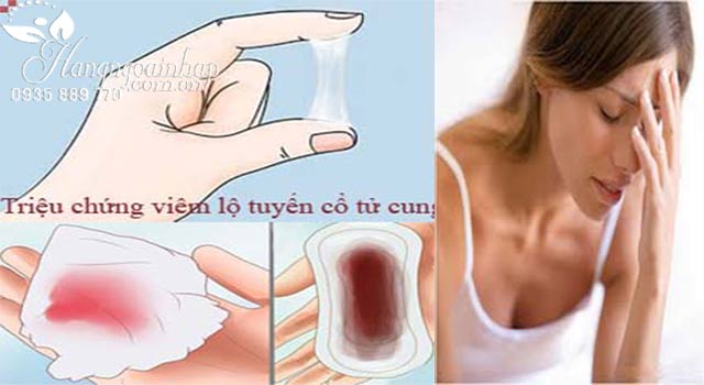 Nguyên nhân viêm lộ tuyến cổ tử cung - Hiểu rõ nguyên nhân và tác động đến sức khỏe phụ nữ