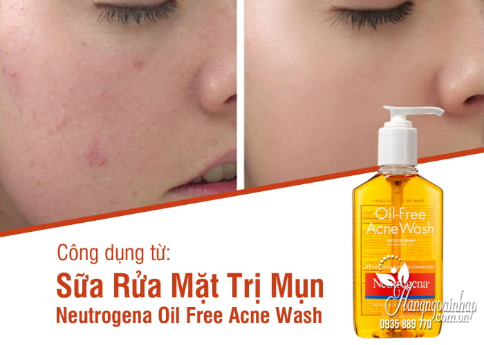 Sữa Rửa Mặt Trị Mụn Neutrogena Oil Free Acne Wash 8