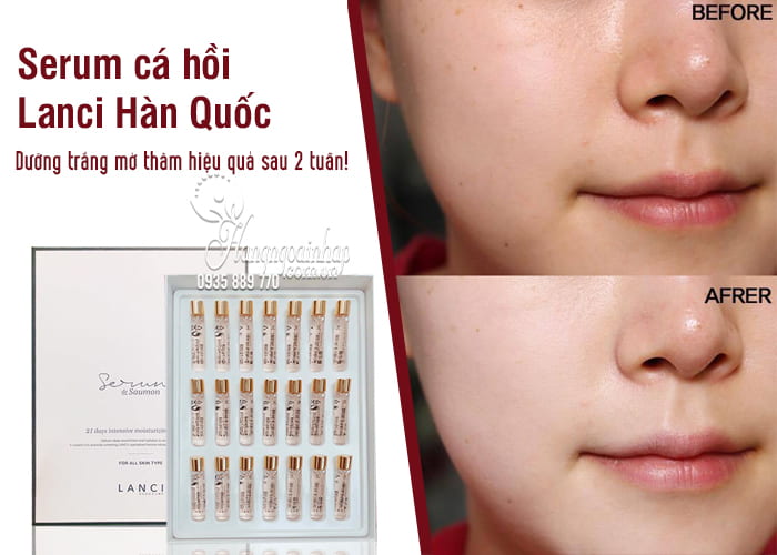 Serum cá hồi Lanci Hàn Quốc mẫu mới hộp 21 lọ chính hãng 5