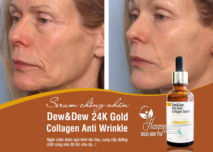 Serum chống nhăn Dew&Dew 24K Gold Collagen Anti Wrinkle 50ml 2