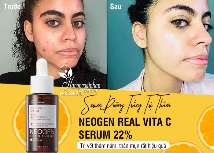 Serum dưỡng trắng trị thâm Neogen Real Vita C Serum 22% 4