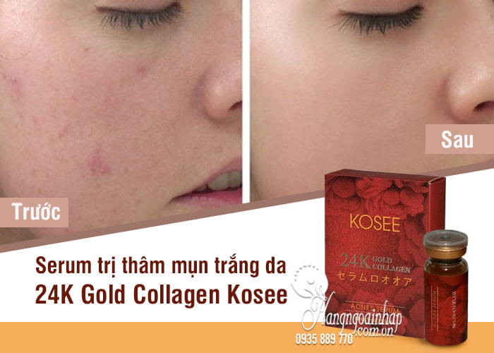 Serum mụn trắng da 24K Gold Collagen Kosee của Nhật Bản 9