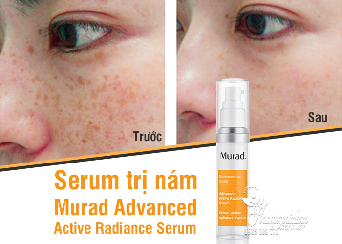 Serum trị nám Murad Advanced Active Radiance Serum 30ml 5