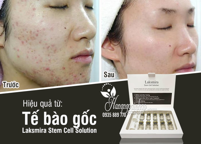 Tế bào gốc Laksmira Stem Cell Solution 10 lọ x 5ml Hàn Quốc 7