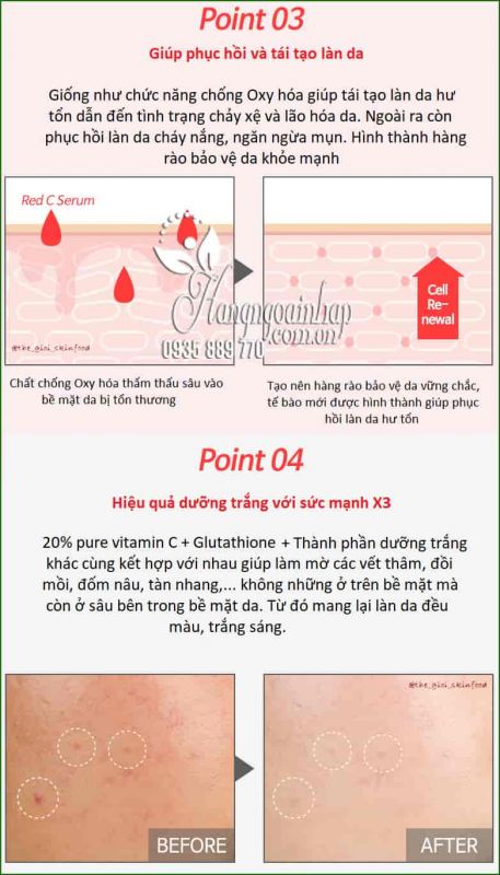 Tinh chất dưỡng trắng, mờ thâm My Signature Red C Serum 30ml 1