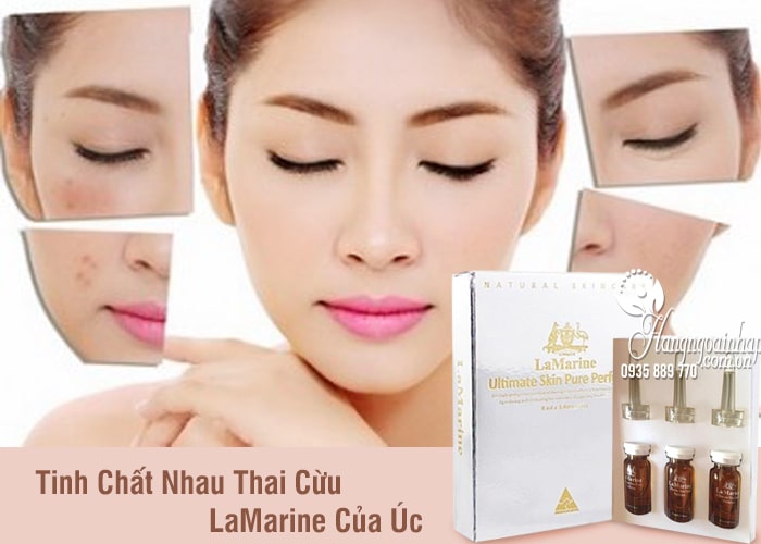 Tinh Chất Nhau Thai Cừu LaMarine Của Úc 2