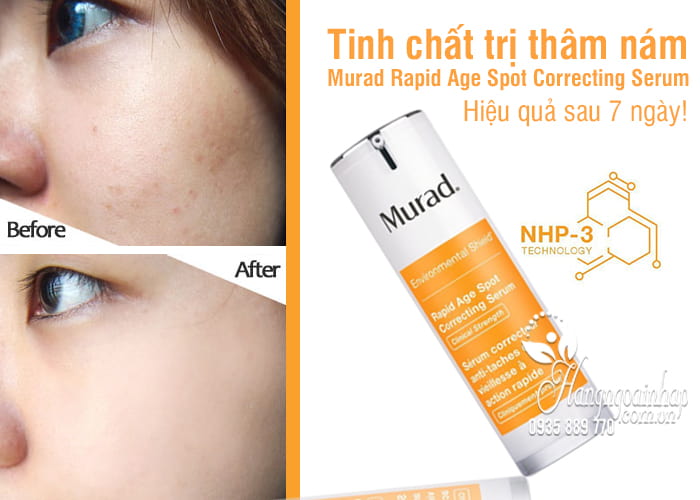 Tinh chất trị thâm nám Murad Rapid Age Spot Correcting Serum 1