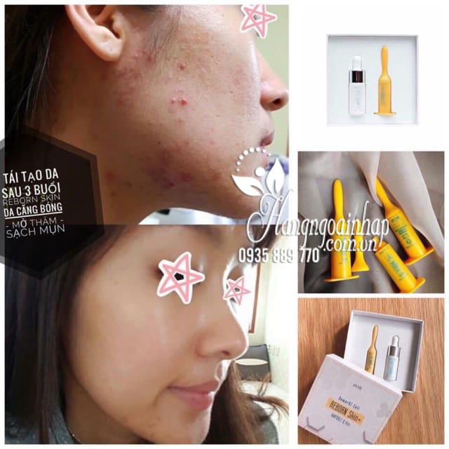 Vi kim tảo biển Genie Demar87 Cell Reborn Skin Hàn Quốc 4